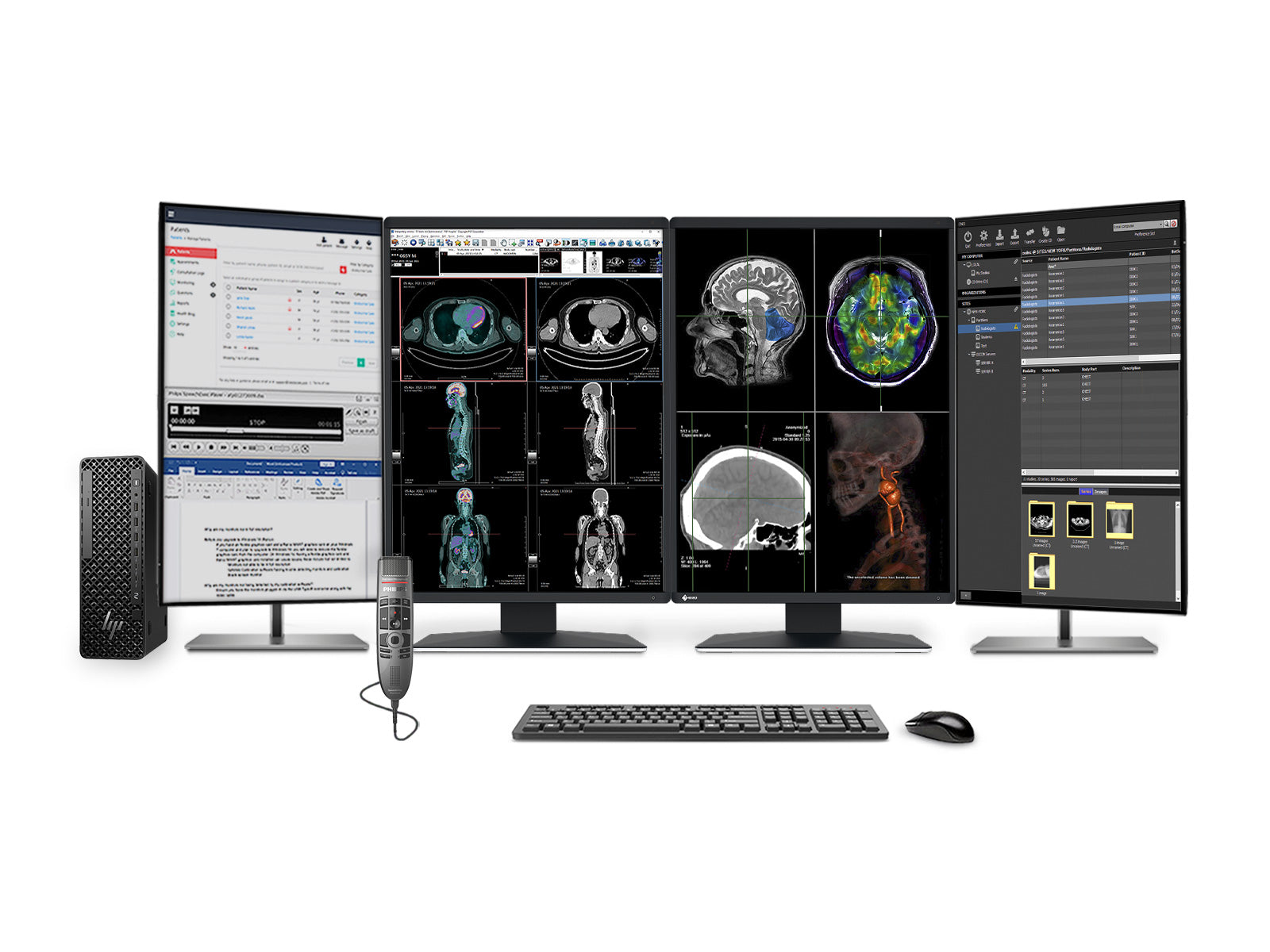 Complete PACS General Radiology Station | Eizo Radiforce RX370 3MP Color LED Displays | Business Class Workstation | Dictation Mic | Worklist Monitor (RX370Z4G5)