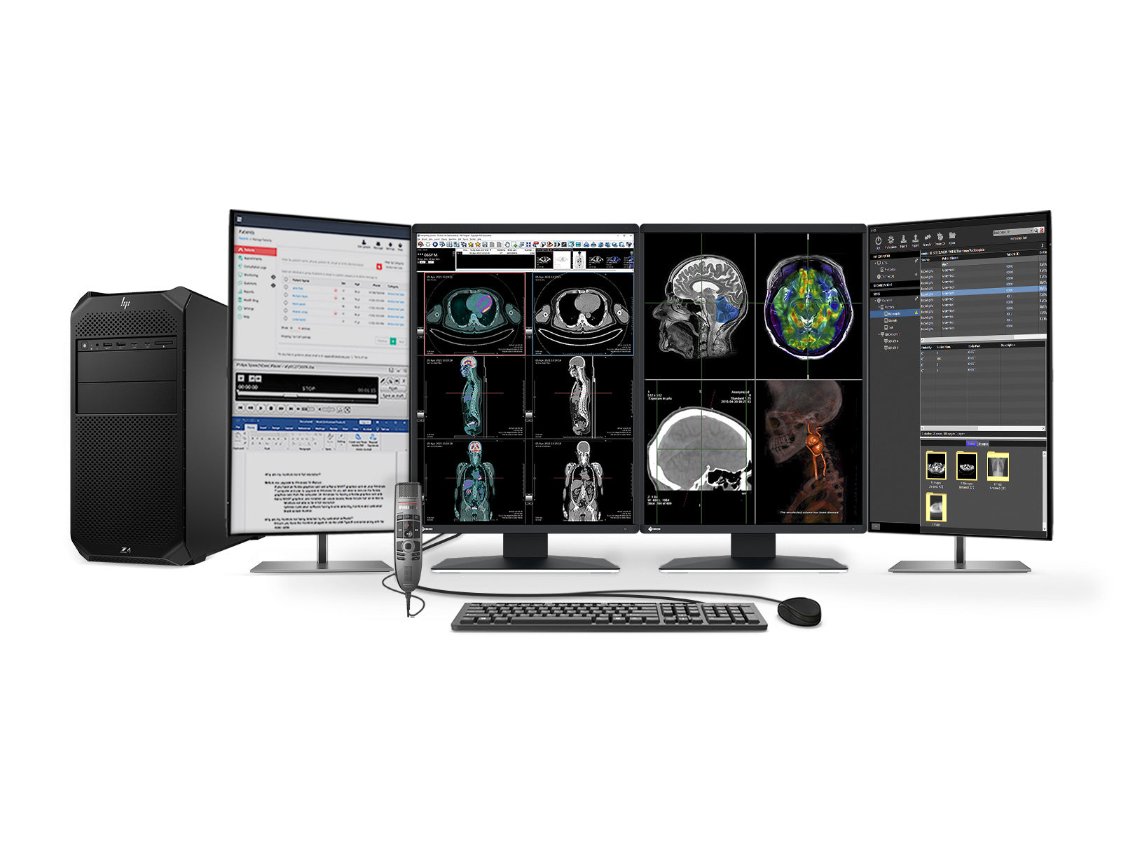 Complete PACS General Radiology Station | Eizo 3MP Color LED Displays | HP Z4 G5 Workstation | Dictation Mic | Worklist Monitor (RX370Z4G5)