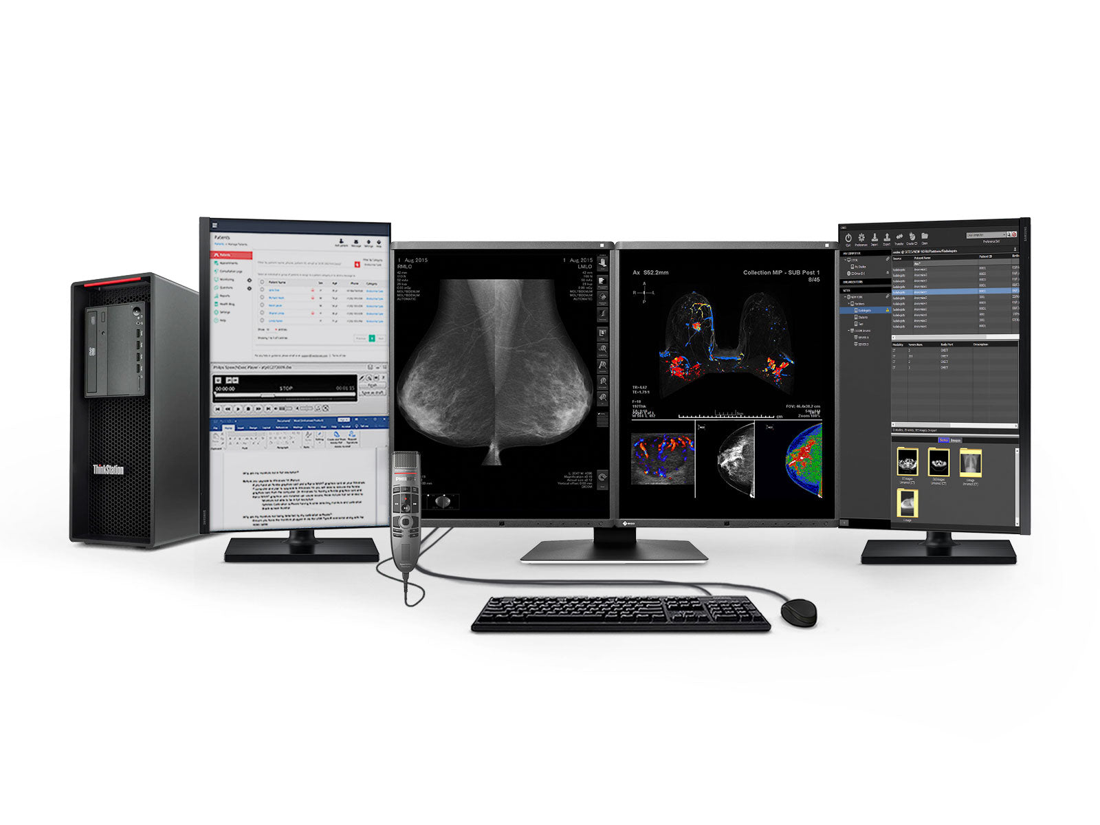 Estación completa de lectura de mamografía | Pantalla a color Eizo de 5MP | Estación de trabajo Lenovo | Micrófono de dictado | Monitores de lista de trabajo (RX560P520)