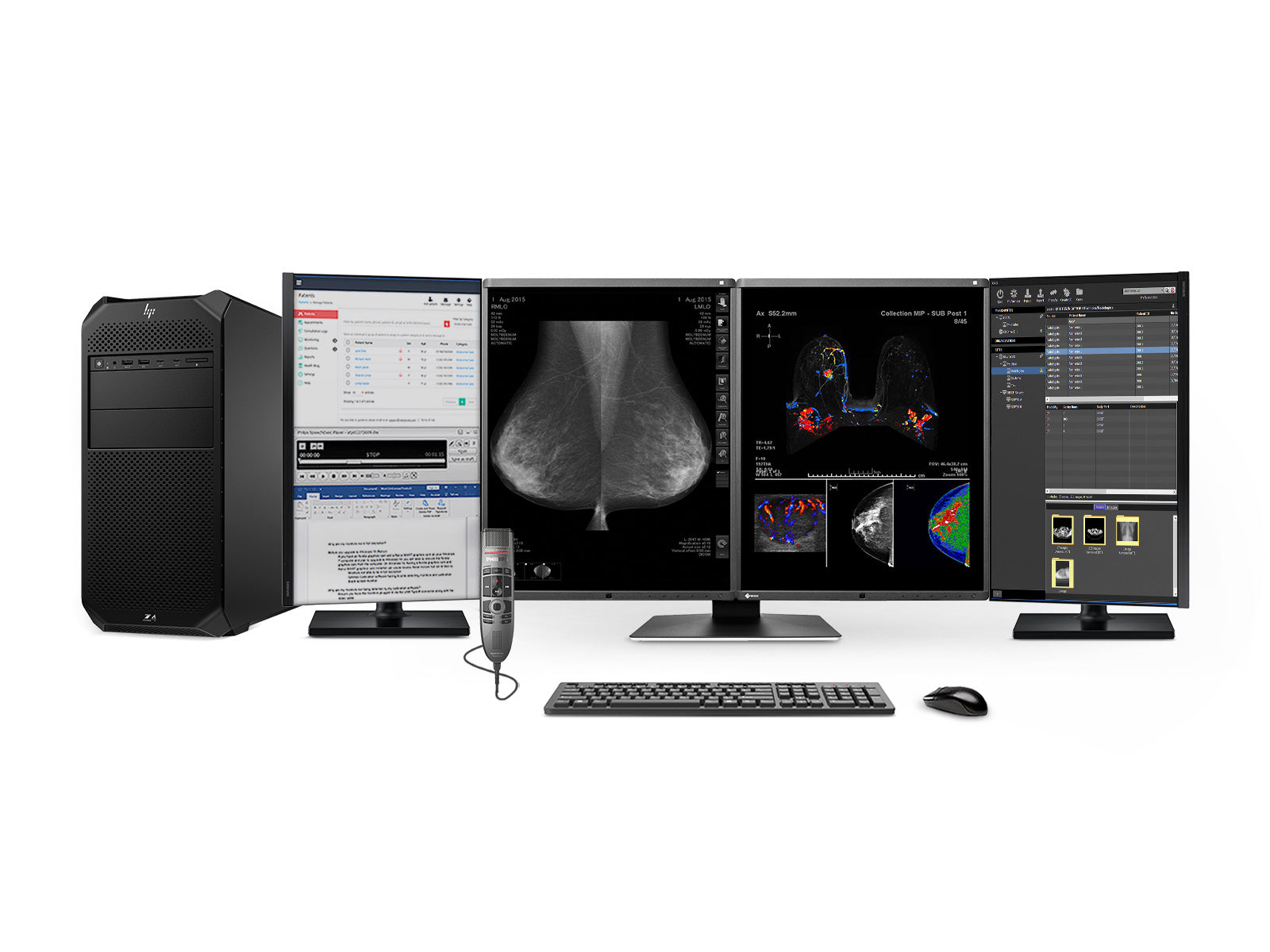 Stazione di lettura mammografica completa | Eizo Radiforce RX560 5MP Monitor mammografici a colori | HP Z4 G5 Postazione di lavoro | Microfono di dettatura | Monitor della lista di lavoro (RX560Z4G5) 