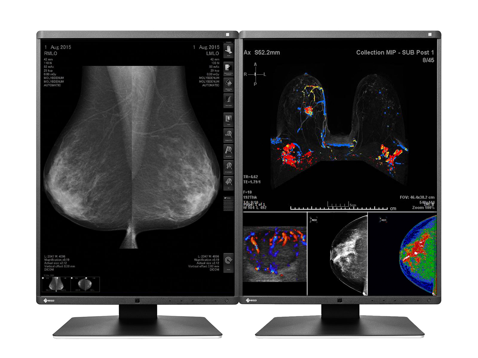 Eizo RadiForce RX560 5MP 21" Color LED Mammo 3D-DBT Breast Imaging Display (RX560-BK) Monitors.com 