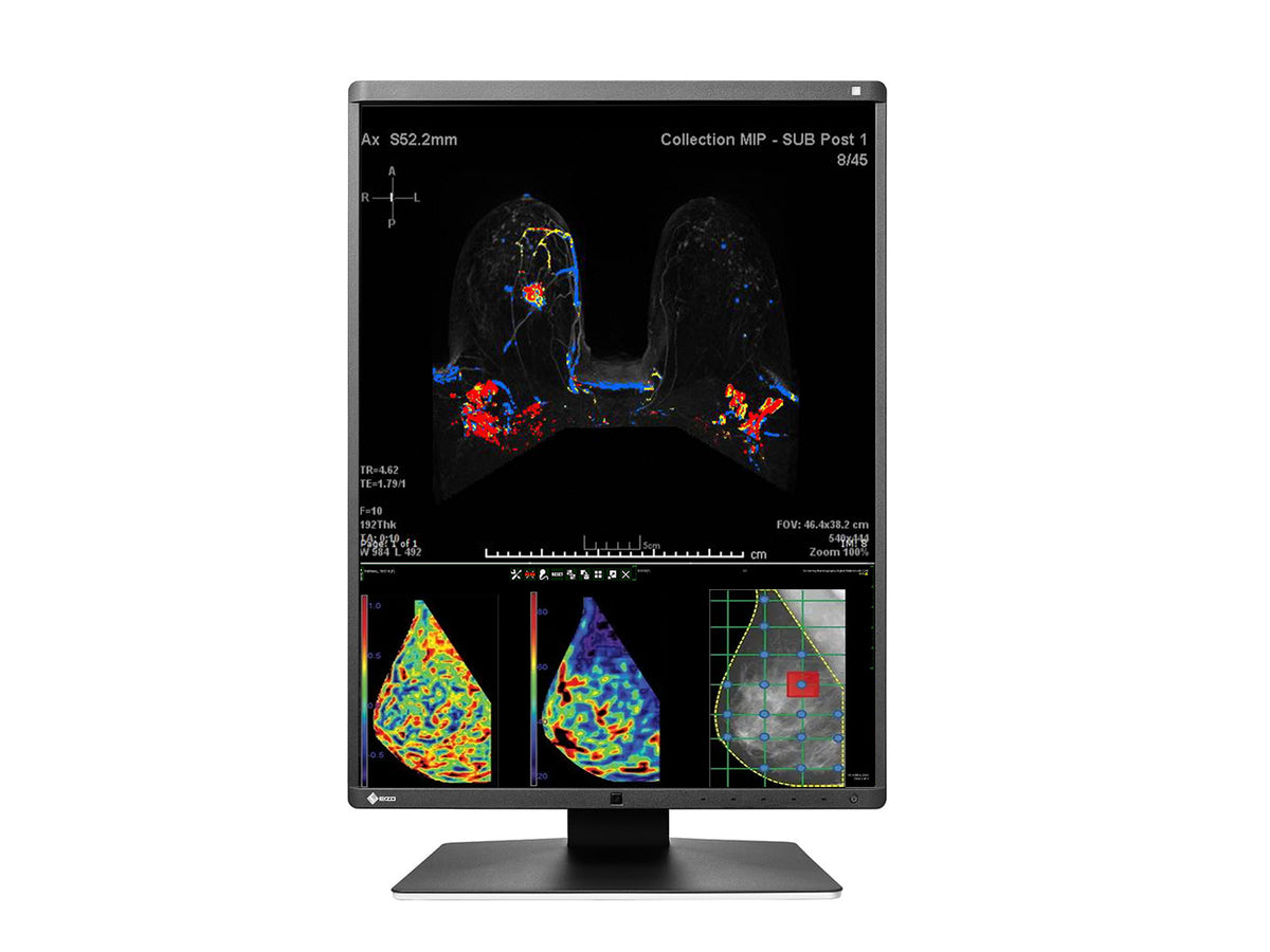 Eizo RadiForce RX570 5MP 21" Color Mammo 3D-DBT Breast Imaging Display (RX570-BK) (New / Single)
