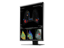 Eizo RadiForce RX570 5MP 21