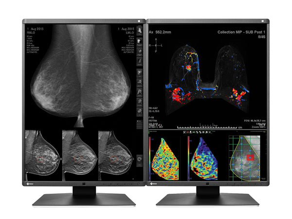 Eizo RadiForce RX570 5MP 21