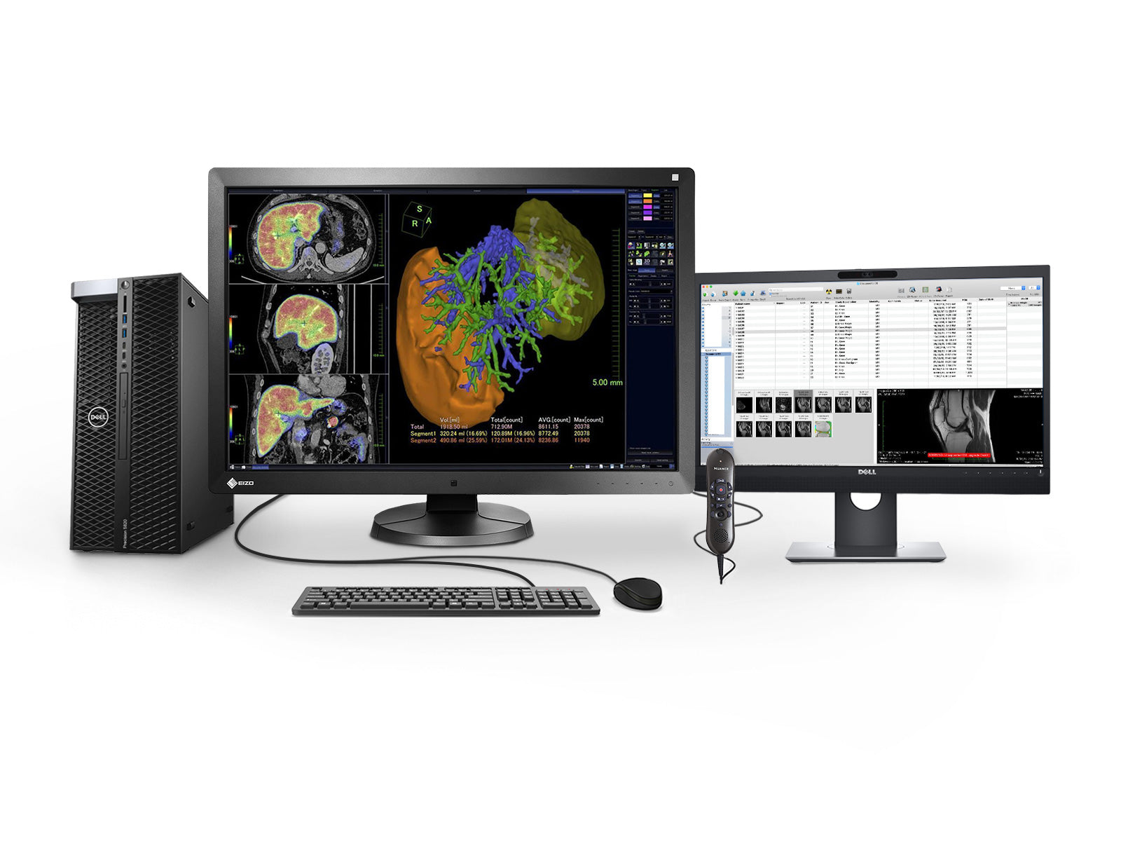 Complete PACS General Radiology Station | Eizo 6MP Color LED Displays | Dell Workstation | Dictation Mic | Worklist Monitor (RX6505820R)