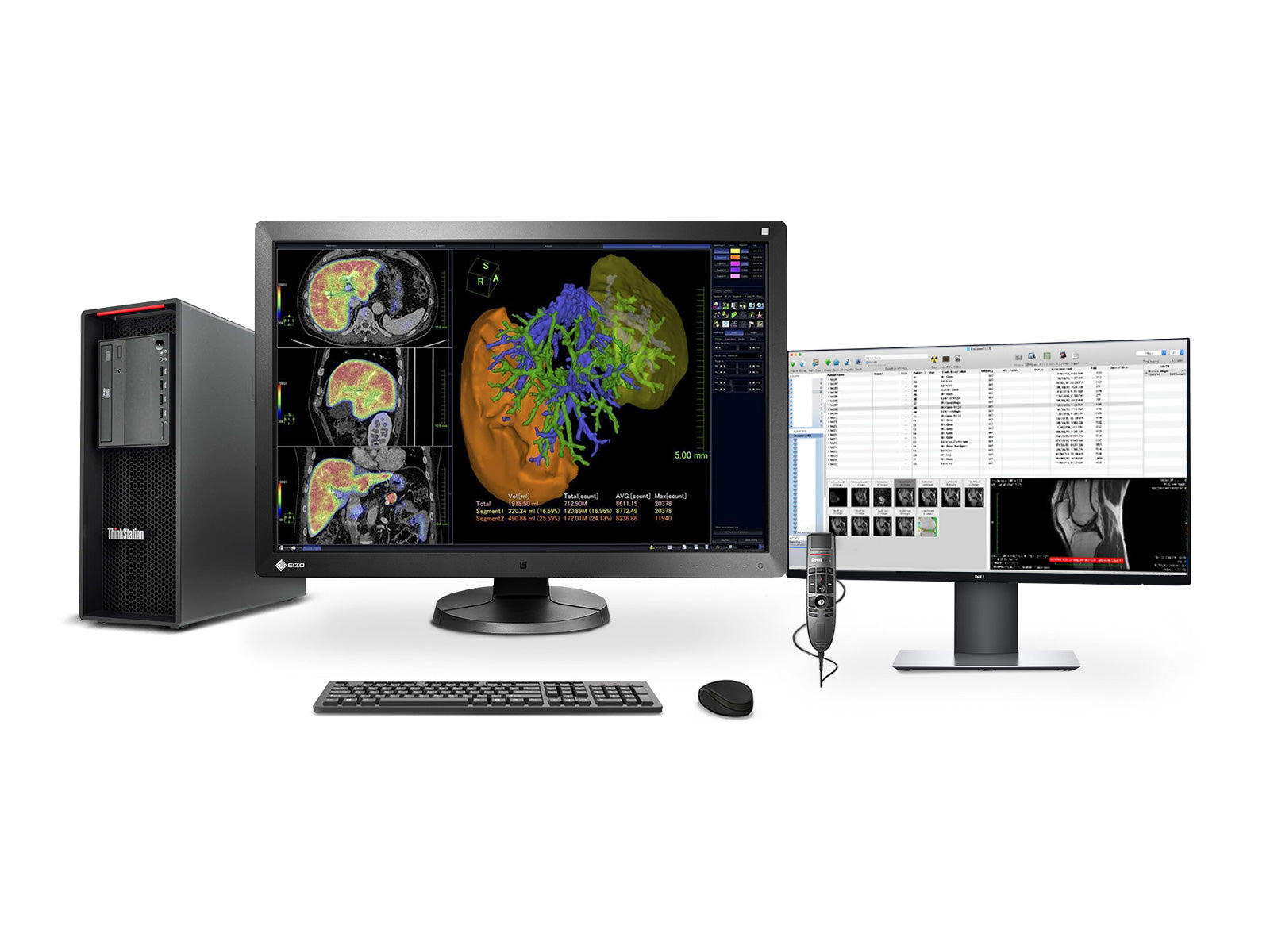 Complete PACS General Radiology Station | Eizo Radiforce RX340 3MP Col