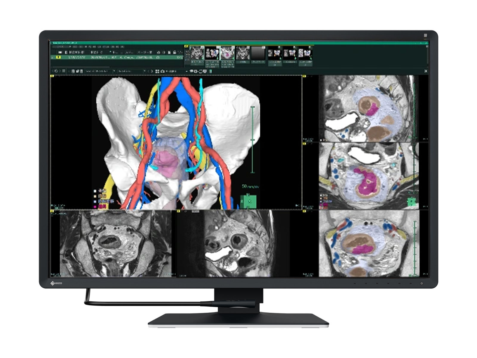 EIZO RadiForce RX440 液晶モニタ29.8 使用时间5451H RadiForce RX440 | EIZO