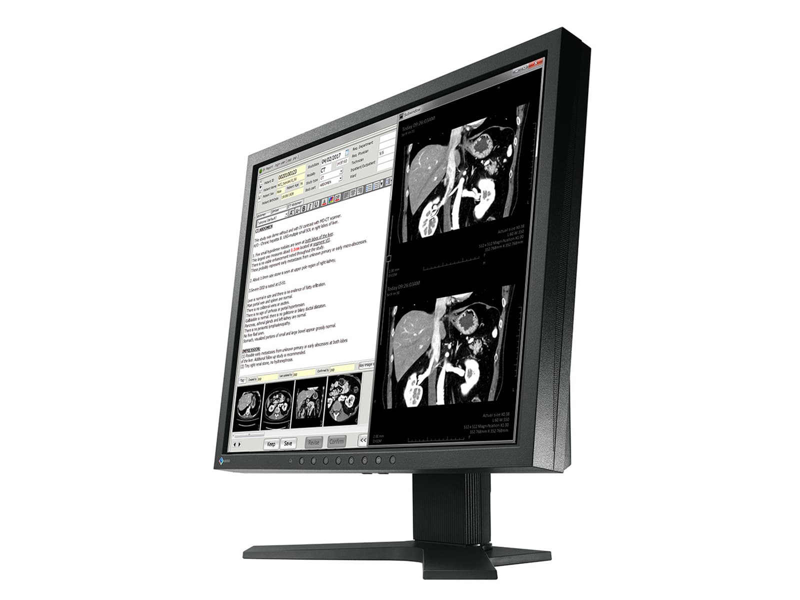 Eizo RadiForce MX192 1MP 19" Color Display Monitor (0FTD2046)