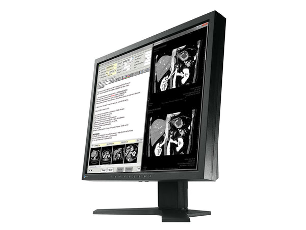 Eizo RadiForce MX192 1MP 19