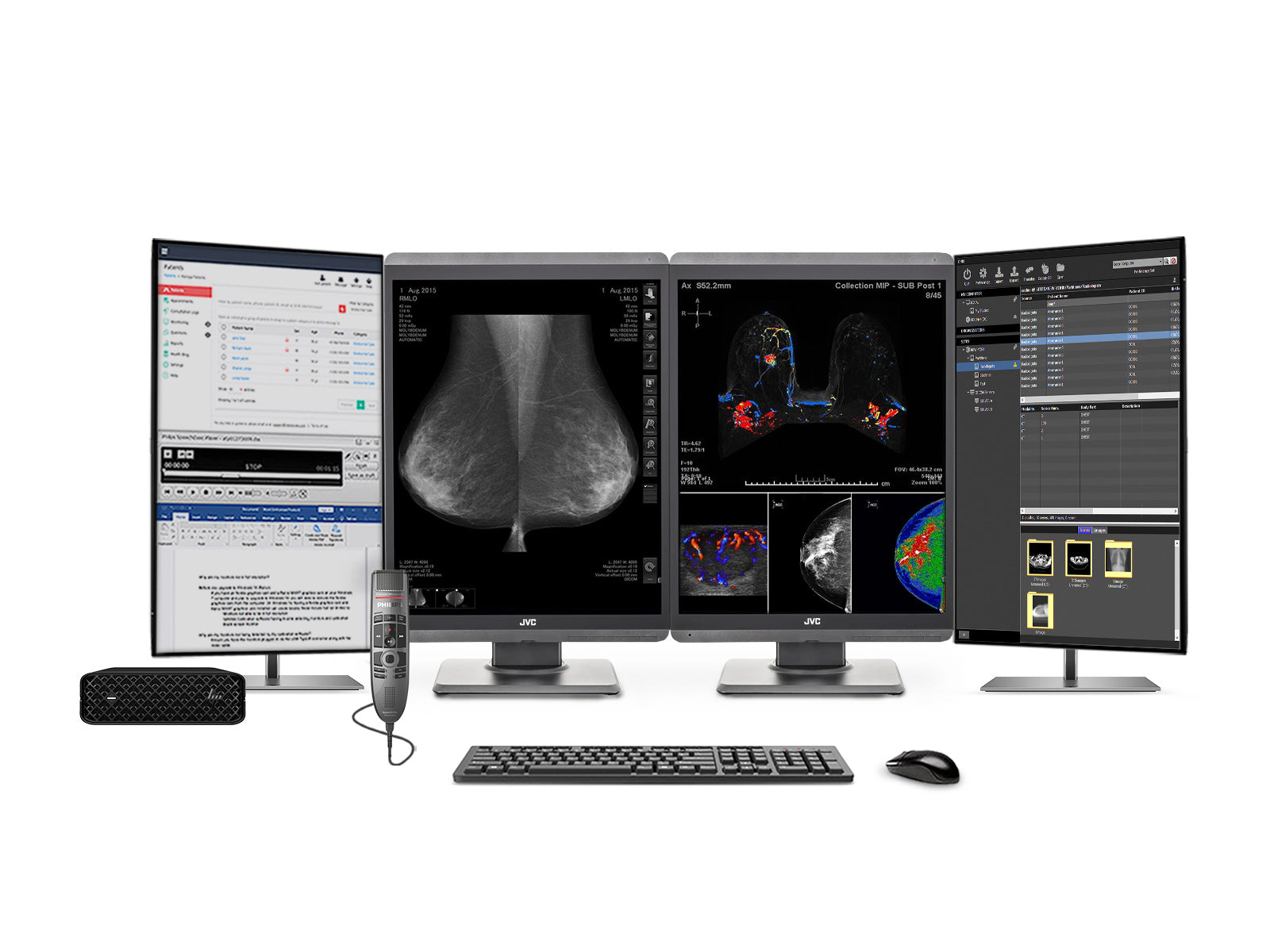 Complete Mammography Reading Station | JVC Totoku CL-S500 5MP Color 3D-DBT Displays | HP Z2 Mini G9 Workstation | Dictation Mic | Worklist Monitors (S500Z2MNG9)