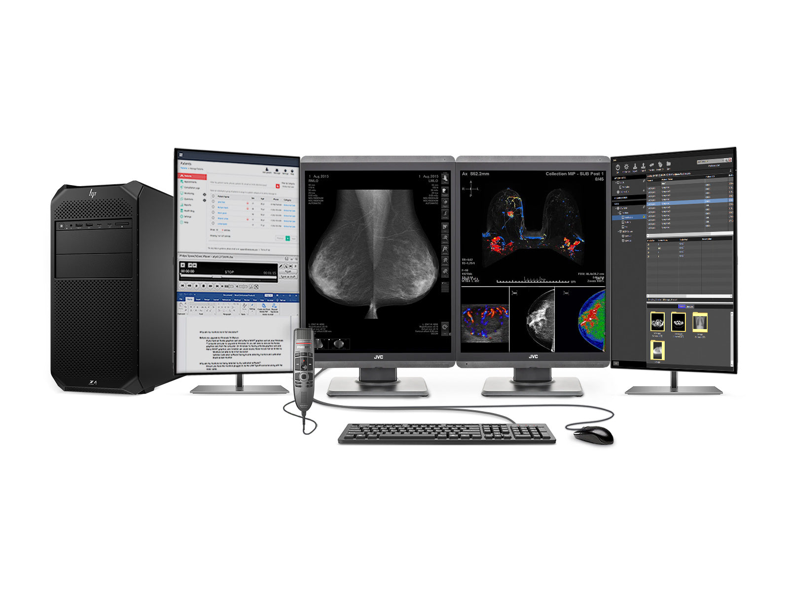 Complete Mammography Reading Station | JVC Totoku 5MP Color 3D-DBT Displays | HP Z4 G5 Workstation | Dictation Mic | Worklist Monitors (S500Z4G5)