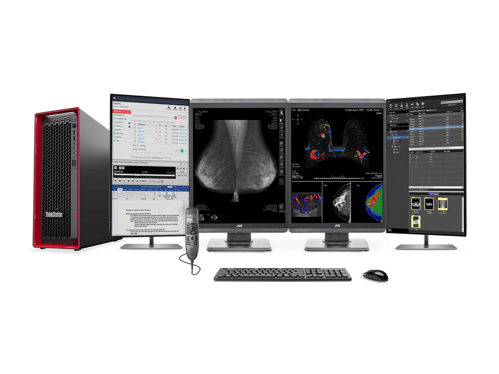 Complete Mammography Reading Station | JVC Totoku CL-S500 5MP Color 3D-DBT Displays | Lenovo P5 Workstation | Dictation Mic | Worklist Monitors (S500Z4G5)
