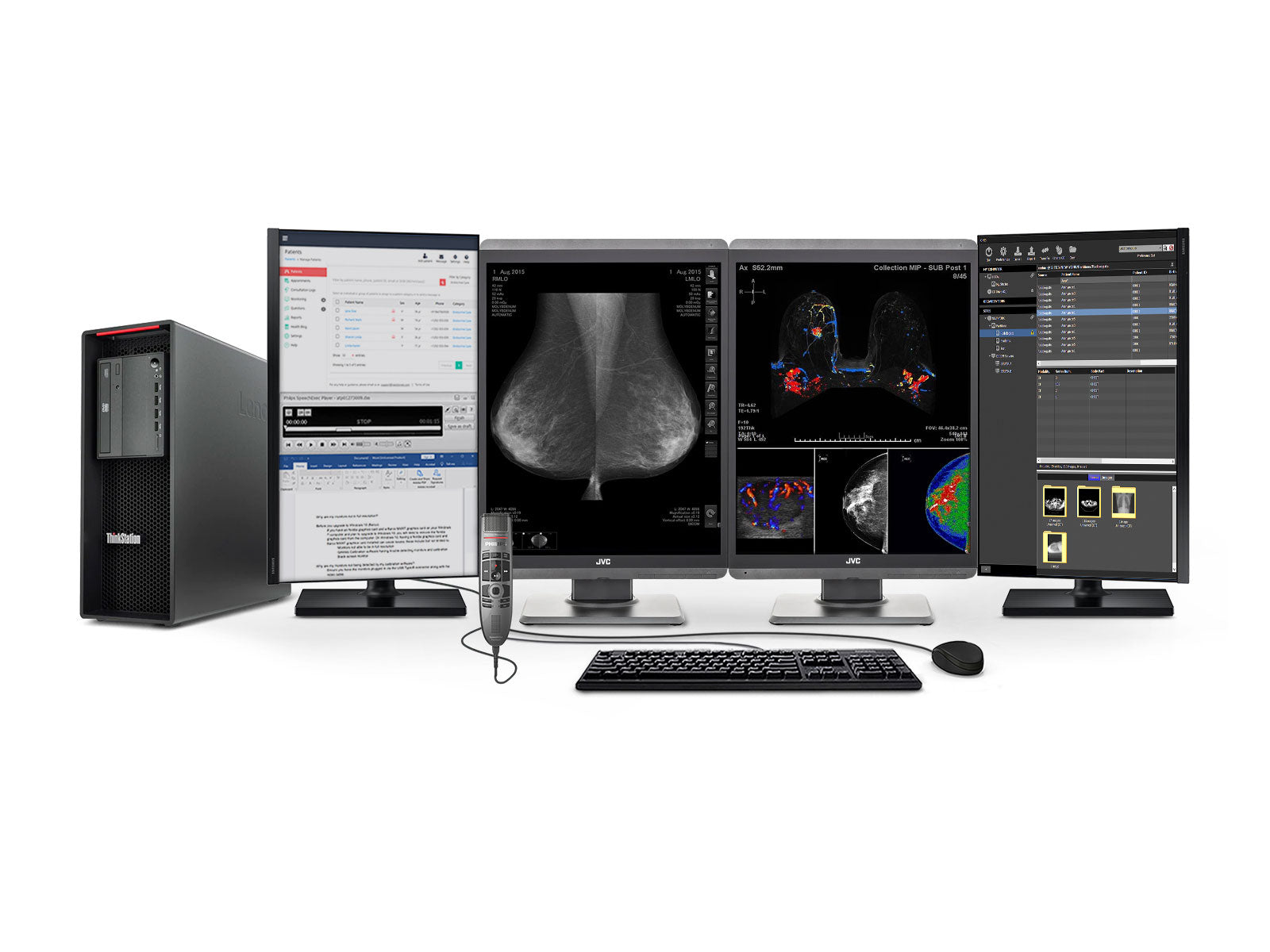 Estación completa de lectura de mamografía | Pantallas 5D-DBT en color JVC Totoku de 3 MP | Estación de trabajo Lenovo | Micrófono de dictado | Monitores de lista de trabajo (S500Z6N)
