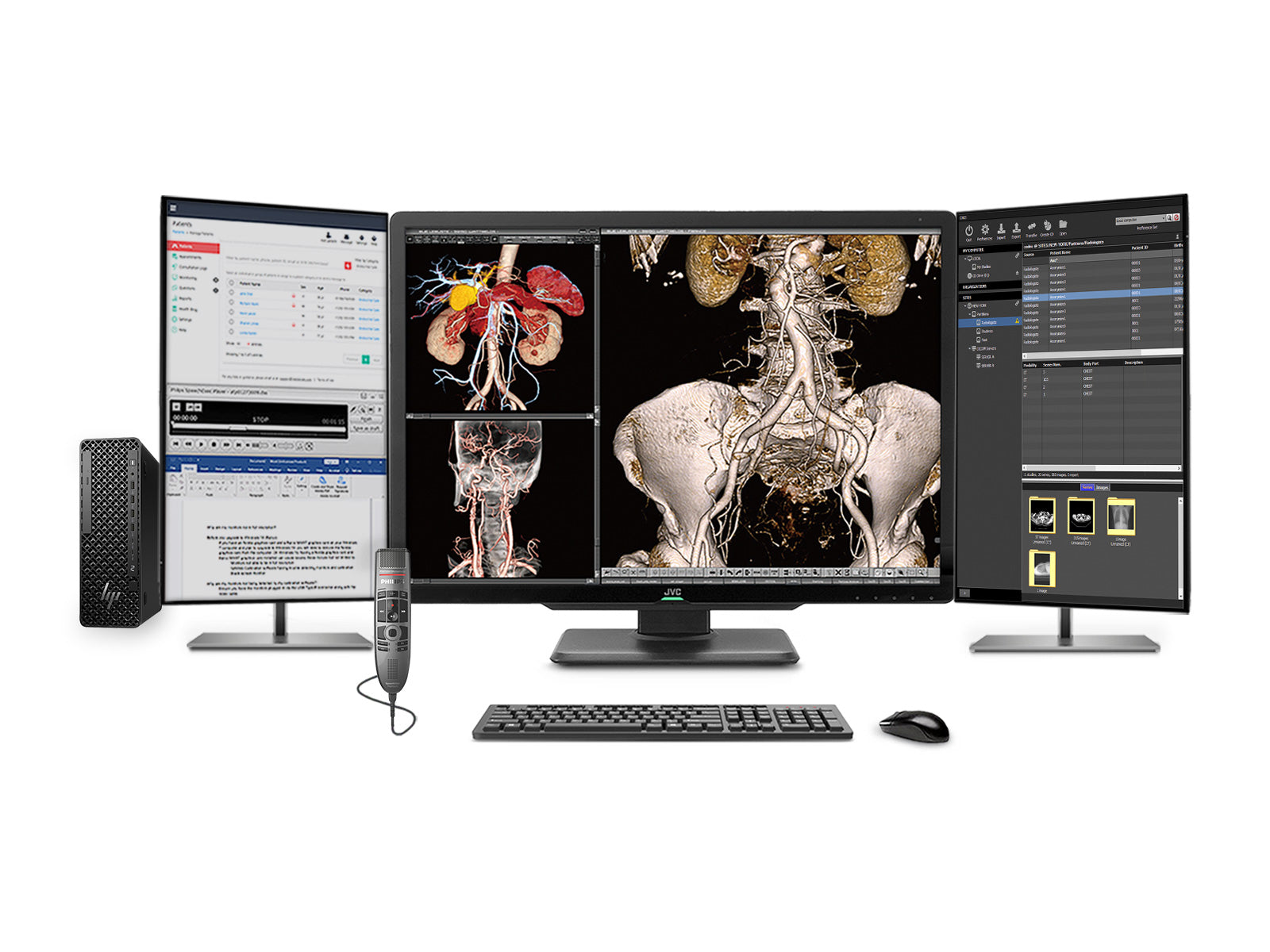 Estación de Radiología General PACS Completa | JVC CL-S600 6MP Pantalla en color | Estación de trabajo de clase empresarial | Micrófono de dictado | Monitor de lista de trabajo (S600Z4G5)