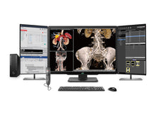 Estação Completa de Radiologia Geral PACS | JVC CL-S600 6MP Display Colorido | Estação de Trabalho Classe Executiva | Microfone para Ditado | Monitor de Lista de Trabalho (S600Z4G5)