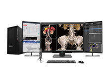 Complete PACS Algemene Radiologie Werkstation | JVC CL-S600 6MP Kleurenscherm | Zakenklasse Werkstation | Dicteermicrofoon | Werklijstmonitor (S600Z4G5)