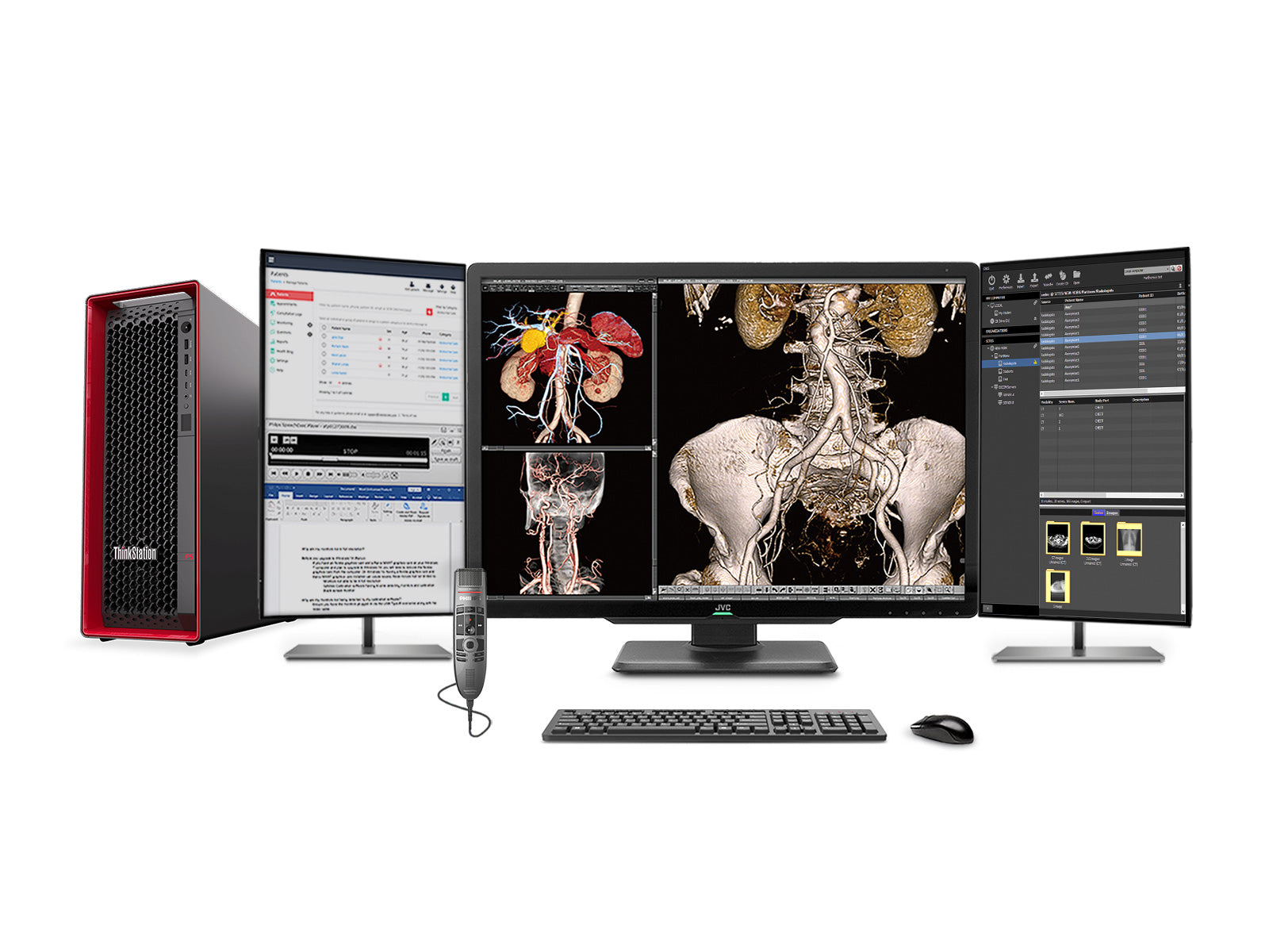 Complete PACS General Radiology Station | JVC CL-S600 6MP Color Display | Lenovo P5 Workstation | Dictation Mic | Worklist Monitor (S600Z4G5)