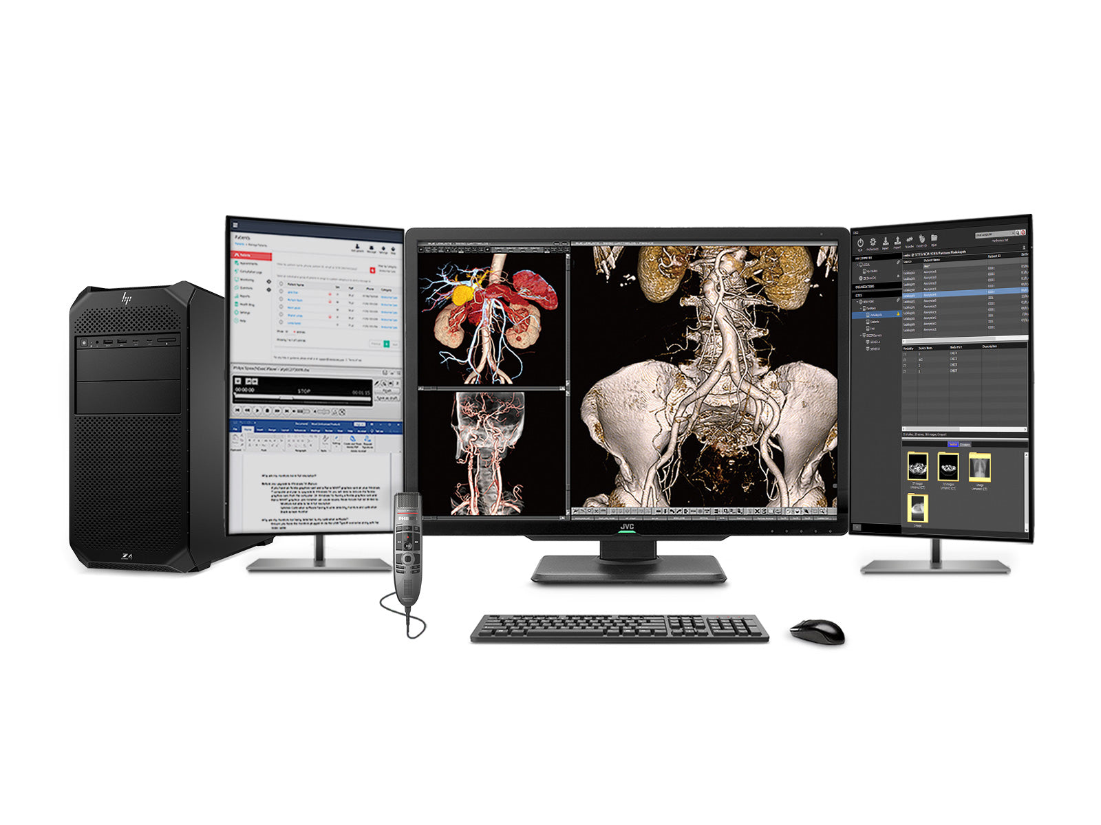 Complete PACS General Radiology Station | JVC CL-S600 6MP Color Display | HP Z4 G5 Workstation | Dictation Mic | Worklist Monitor (S600Z4G5)