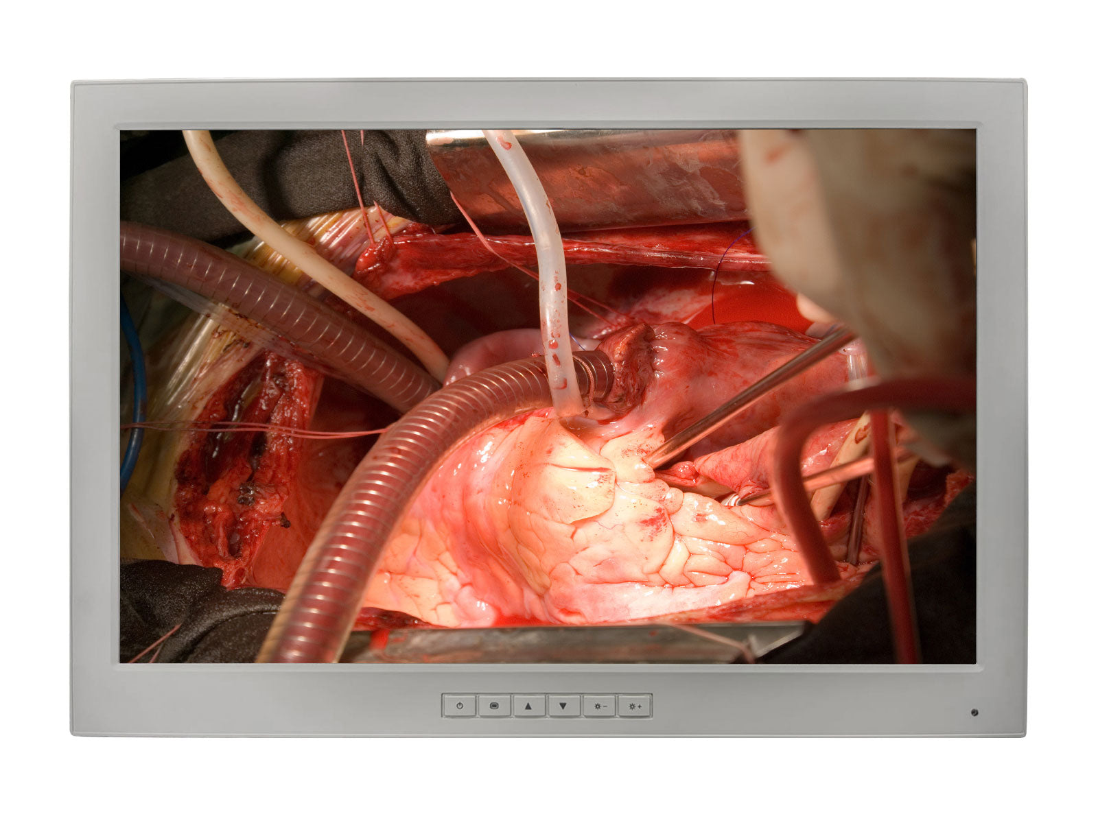Barco SN240S1 MED24ESH 24" WUXGA 1920 x 1200 2MP Philips DICOM Clinical Review Monitor by Fimi Barco (SN240S1)