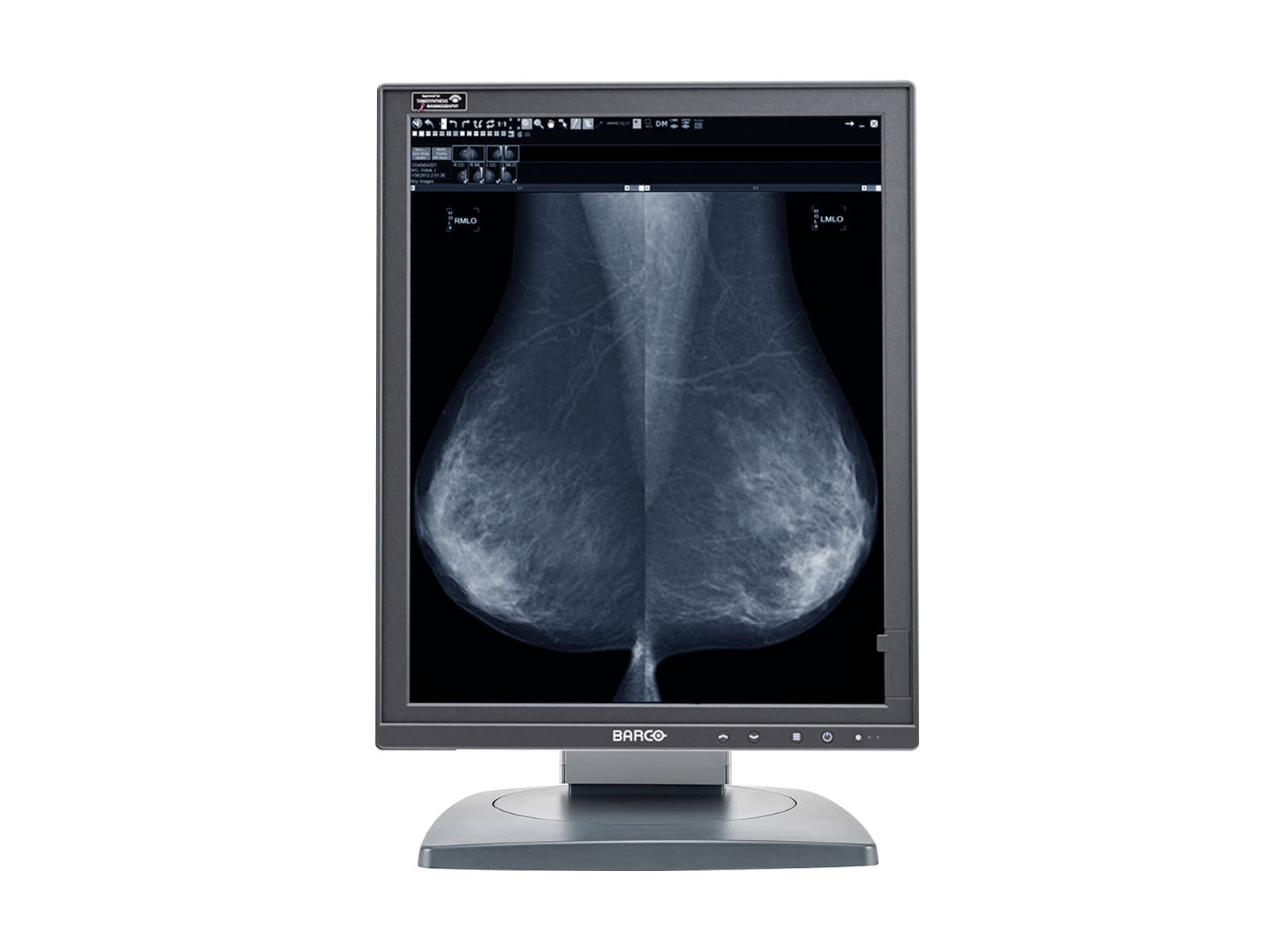 Barco Coronis MDMG-5221 5MP 21" Grayscale Tomosynthesis 3D-DBT Mammography Display