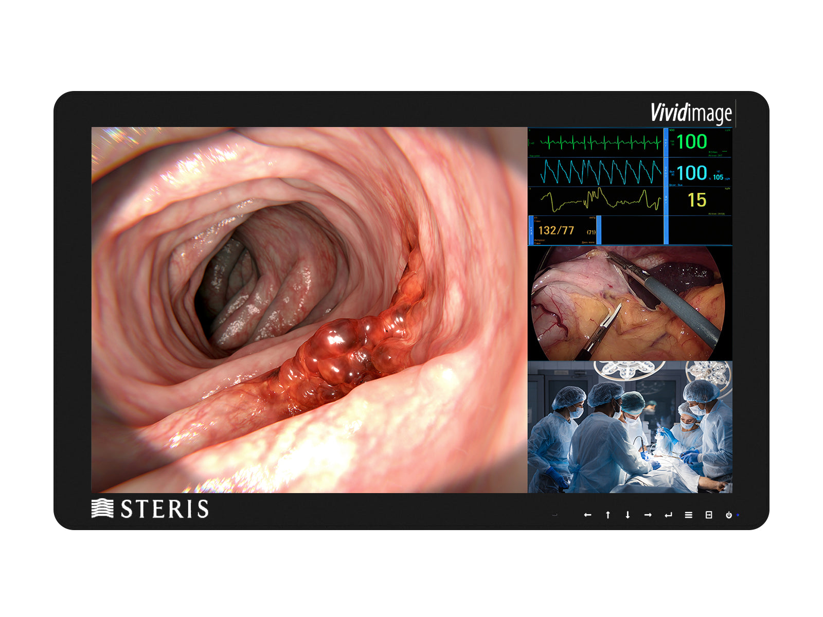 Steris Vividimage D RLM27HD2 Monitor quirúrgico en color HD de 27" (RLM27HD2)
