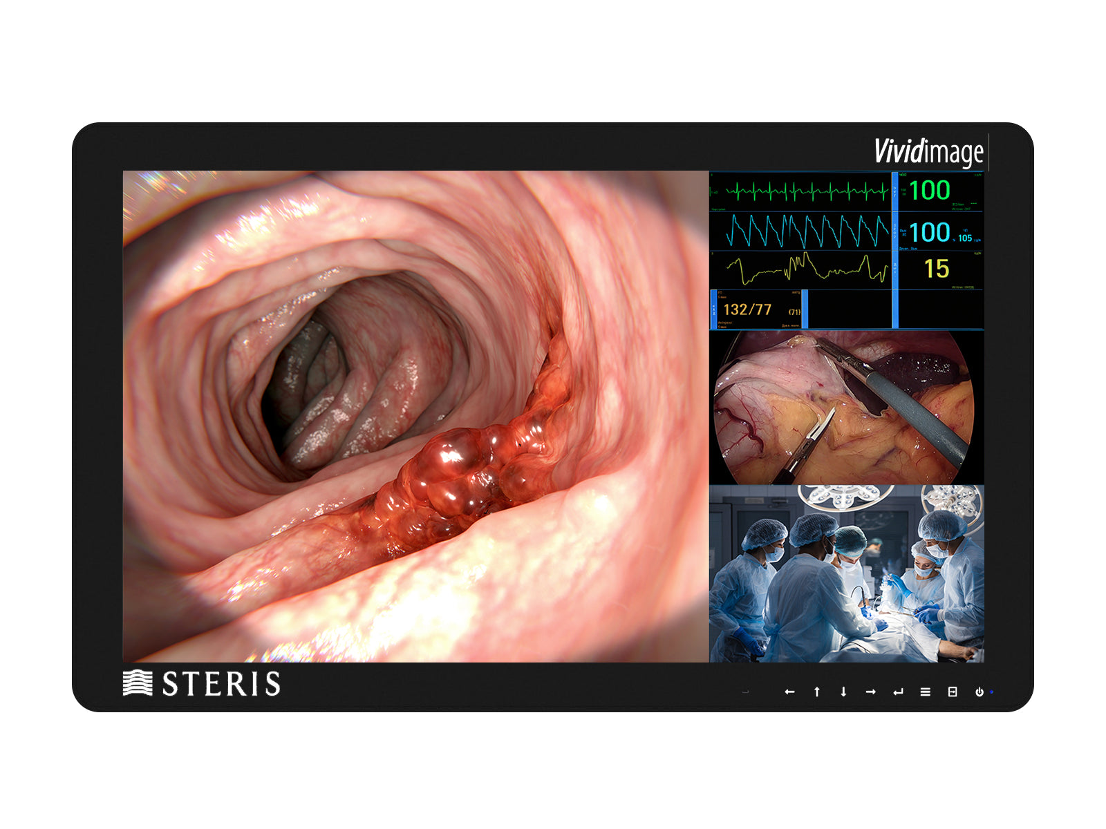 Steris Vividimage D RLM27HD2 27" HD Color Surgical Display Monitor (RLM27HD2) Monitors.com 