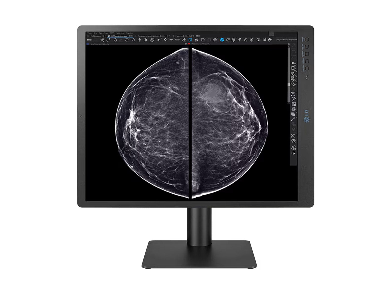 LG 5MP 21" Color Mammography 3D-Tomosynthesis Breast Imaging Display Monitor (21HQ613D)