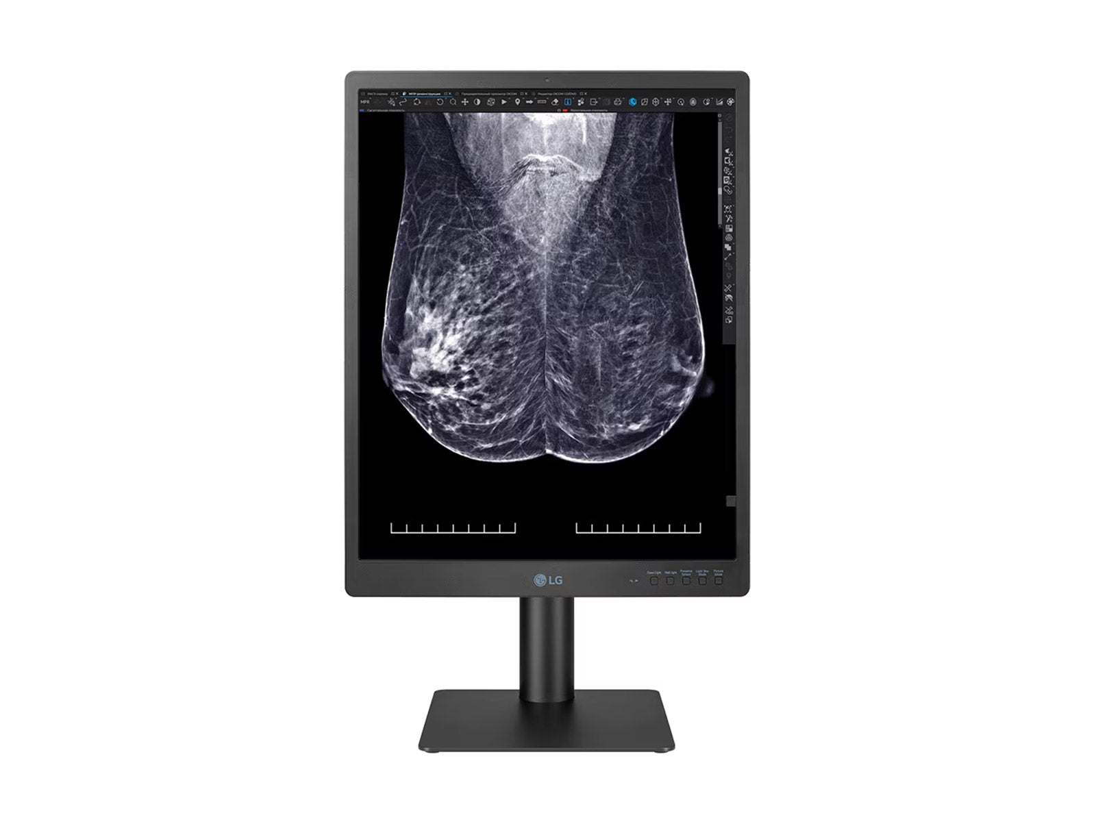 LG 5MP 21" Color Mammography 3D-Tomosynthesis Breast Imaging Display Monitor (21HQ613D)