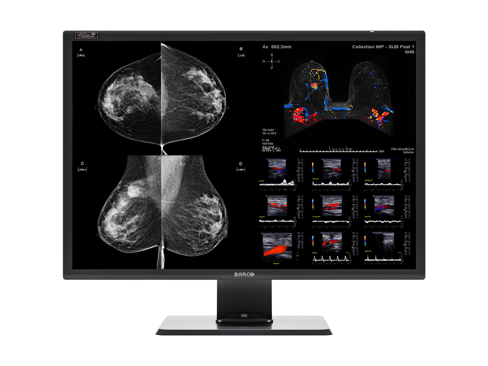 Station complète de lecture de mammographie | Barco Écran couleur 12MP | Poste de travail Lenovo | Micro de dictée | Moniteurs de liste de travail (12130P520)