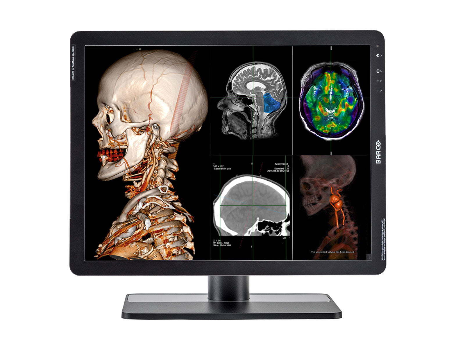 Barco Eonis MDRC-2221 2MP 21" Color LED Clinical Review Display Monitor Monitors.com 