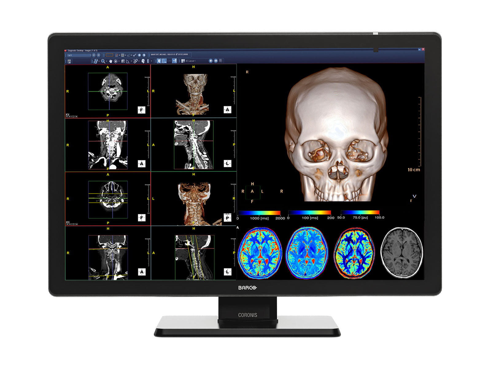 Barco Coronis Fusion MDCC-4430 4MP 30" Color LED Medical Diagnostic PACS Display
