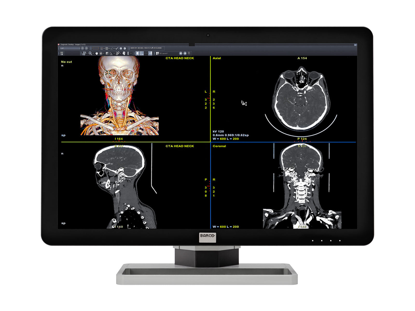 Barco Allgemeine Radiologie-Lesestation | Coronis 6MP MDCC-6430 | Dell i9 Workstation | Nuance-Mikrofon | 24-Zoll-Arbeitslistenmonitore (64305820)