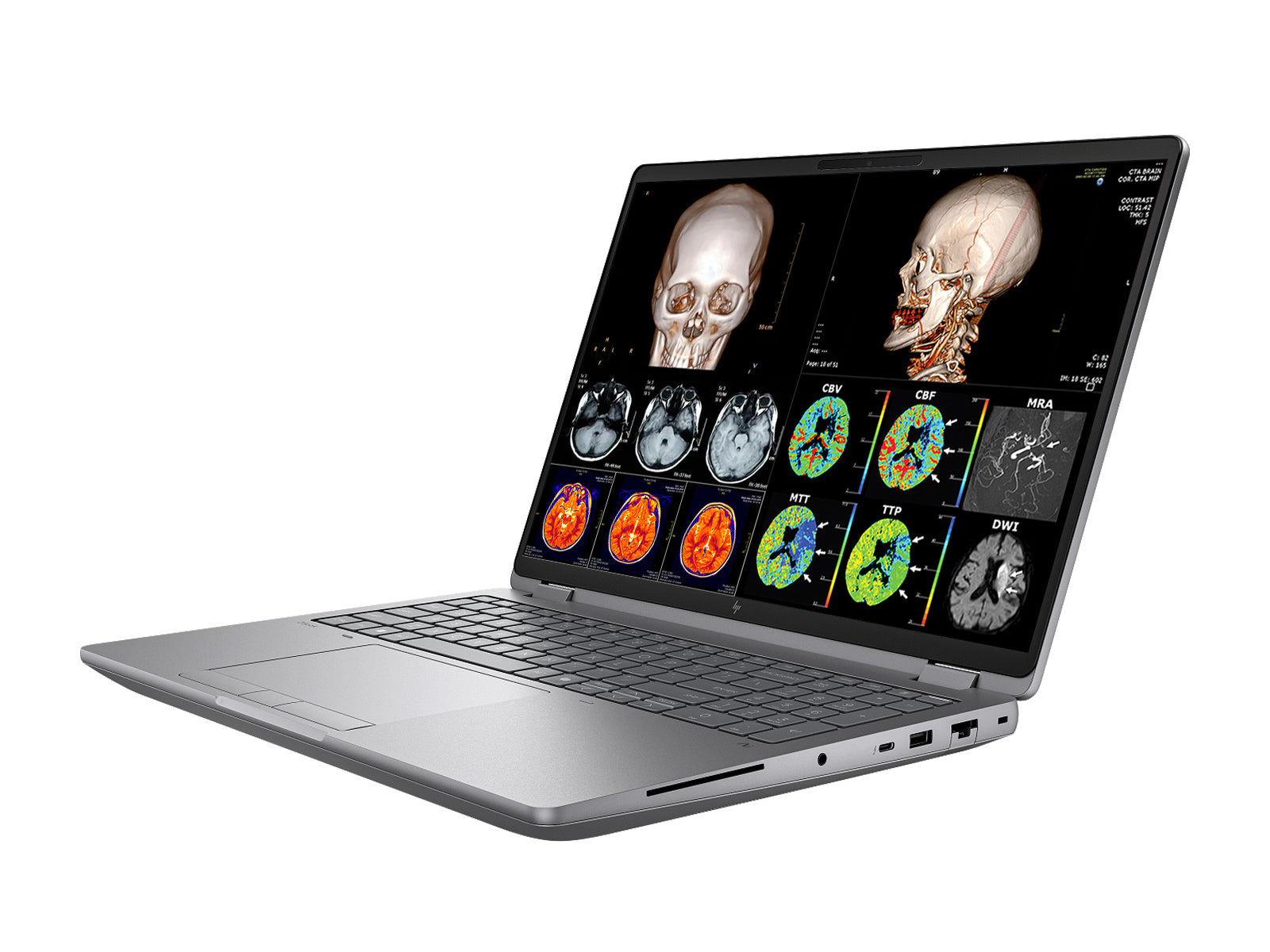 HP ZBook Fury G1i 16 Mobile Workstation DICOM PerfectLUM Medizinisch