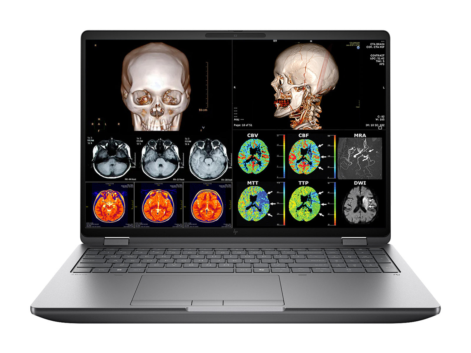 HP ZBook Fury G1i 16 Mobile Workstation | 16" DICOM Calibrated 9MP OLED 4K+ UHD WQUXGA (3840 x 2400) Display | Intel Core Ultra 9 285HX @ 5.5GHz MT | 24-Core | 128GB DDR5 | 512GB NVMe SSD | RTX PRO 5000 Blackwell 24GB | WiFi 7 | PerfectLUM License