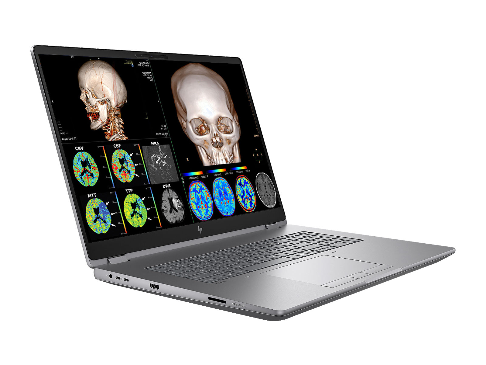 HP ZBook Fury G1i 18 Mobiele Werkstation DICOM