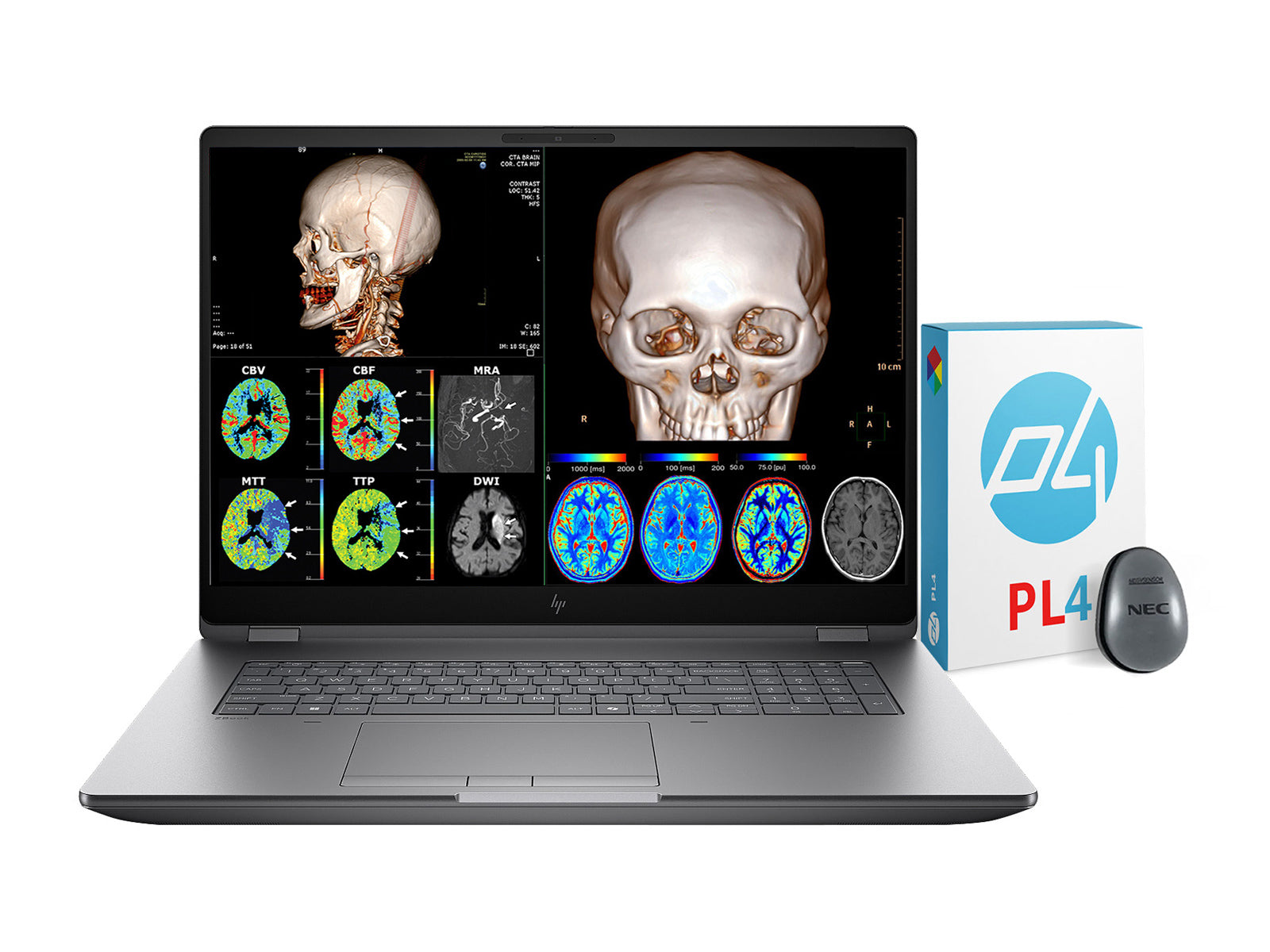 HP ZBook Fury G1i 18 Mobile Workstation | 18" DICOM Calibrated WQXGA QHD+ 4MP (2560 x 1600) Display | Intel Core Ultra 7 255HX @ 5.2GHz MT | 20-Core | 128GB DDR5 | 512GB NVMe SSD | Intel UHD Graphics | WiFi 7 | PerfectLUM License