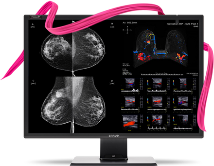 NEW Barco Nio Fusion 12MP
