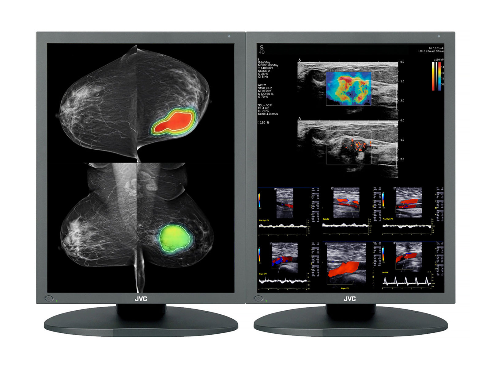 JVC Totoku CCL550i2 5MP Mammography Display Monitor