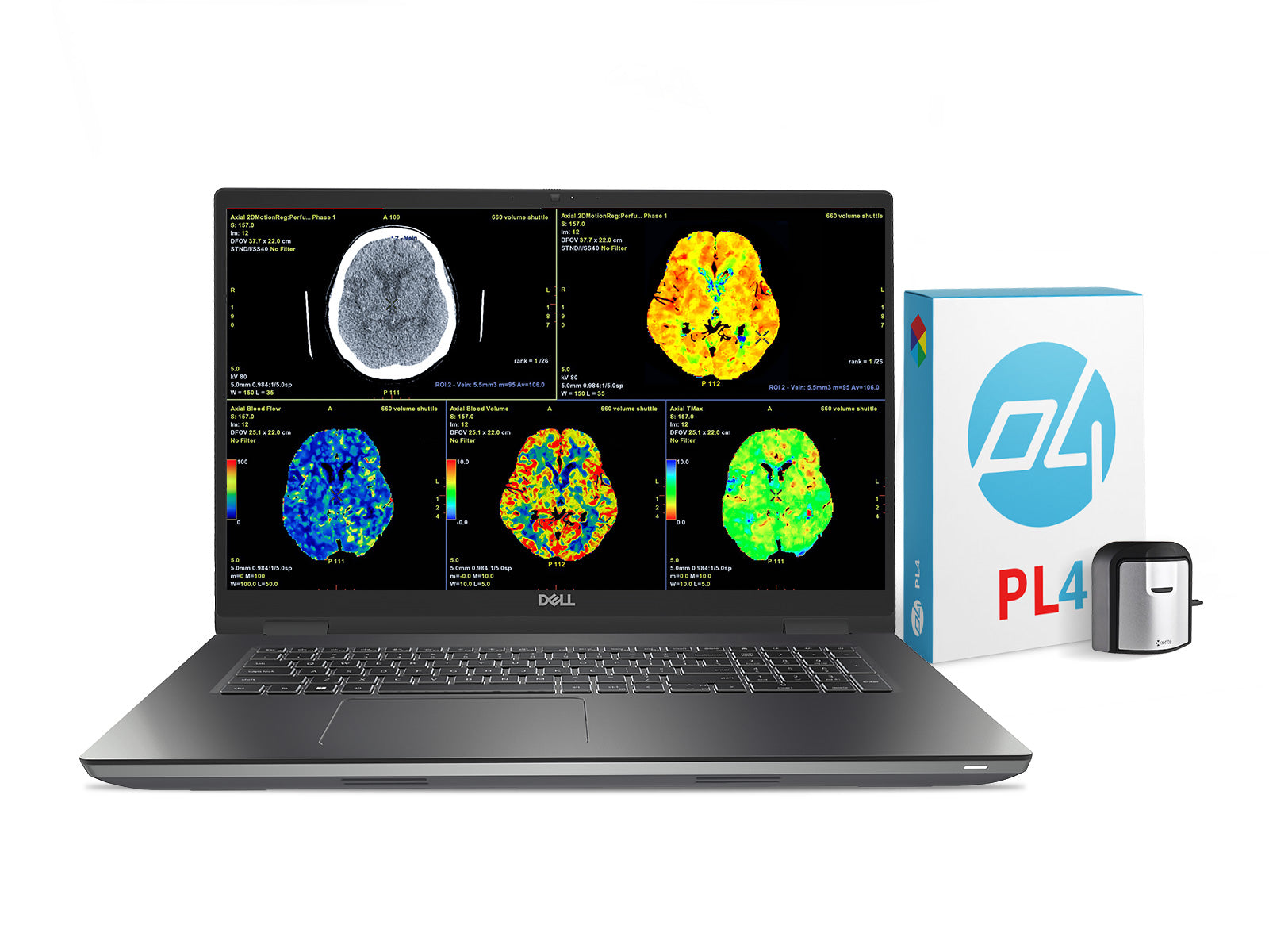 Dell Precision 7770 Mobile Radiology Workstation | 17.3" 8MP 4K UHD DICOM Calibrated | Core i7-12850HX @ 4.8GHz | 128GB DDR5 | 1TB NVMe SSD | RTX A3000 12GB | WiFi 6E