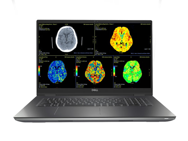 Dell Precision 7770 Mobile Radiology Workstation | 17.3" 8MP 4K UHD DICOM Calibrated | Core i7-12850HX @ 4.8GHz | 64GB DDR5 | 1TB NVMe SSD | RTX A3000 12GB | WiFi 6E