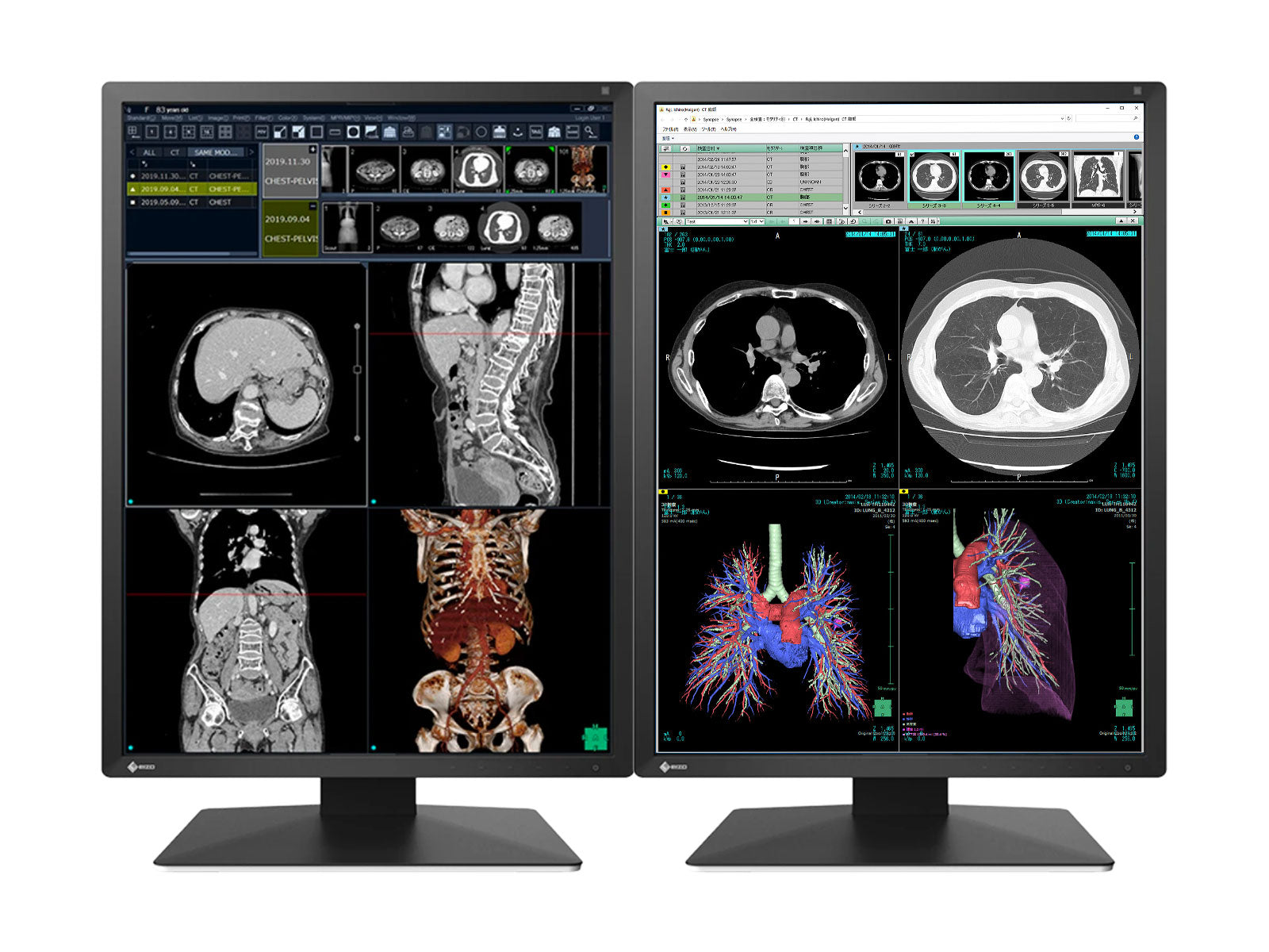 Eizo RadiForce RX270 2MP 21" Color LED Monitor de pantalla de radiología de diagnóstico médico (RX270-BK)