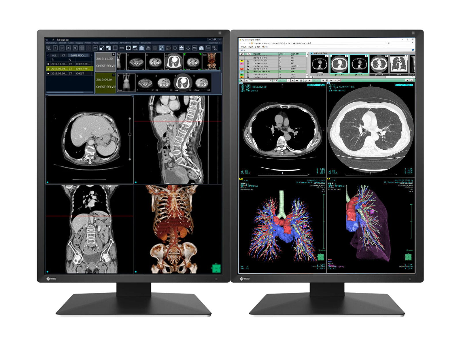 Eizo RadiForce RX270 2MP 21" Moniteur d'affichage de radiologie diagnostique médical LED couleur (RX270-BK)