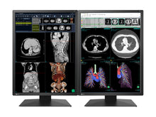 Eizo RadiForce RX270 Monitor per radiologia diagnostica medica a colori da 2 MP 21" (RX270-BK)