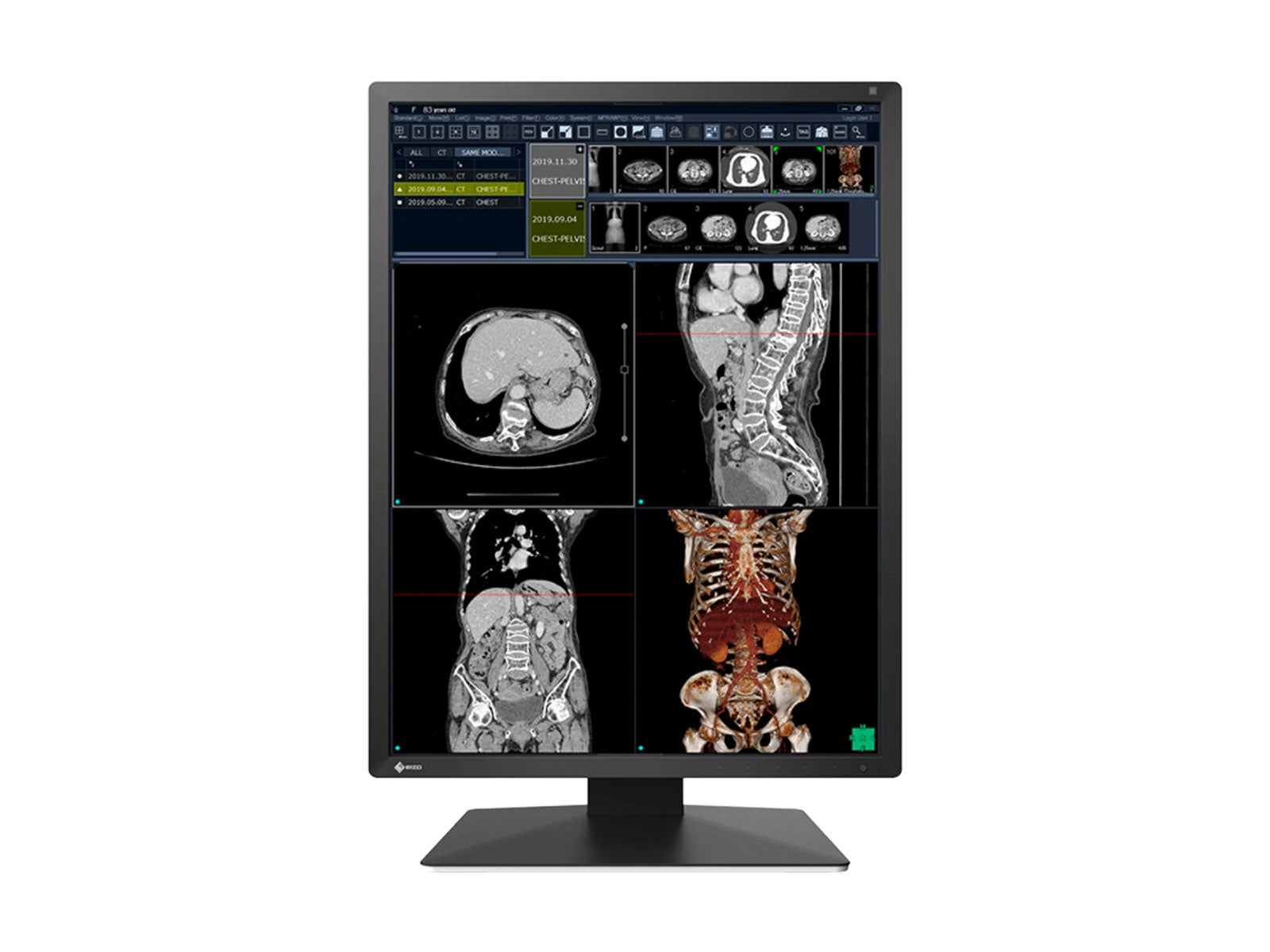 Eizo RadiForce RX270 2MP 21" Farb-LED-Monitor für medizinische Diagnostik und Radiologie (RX270-BK)
