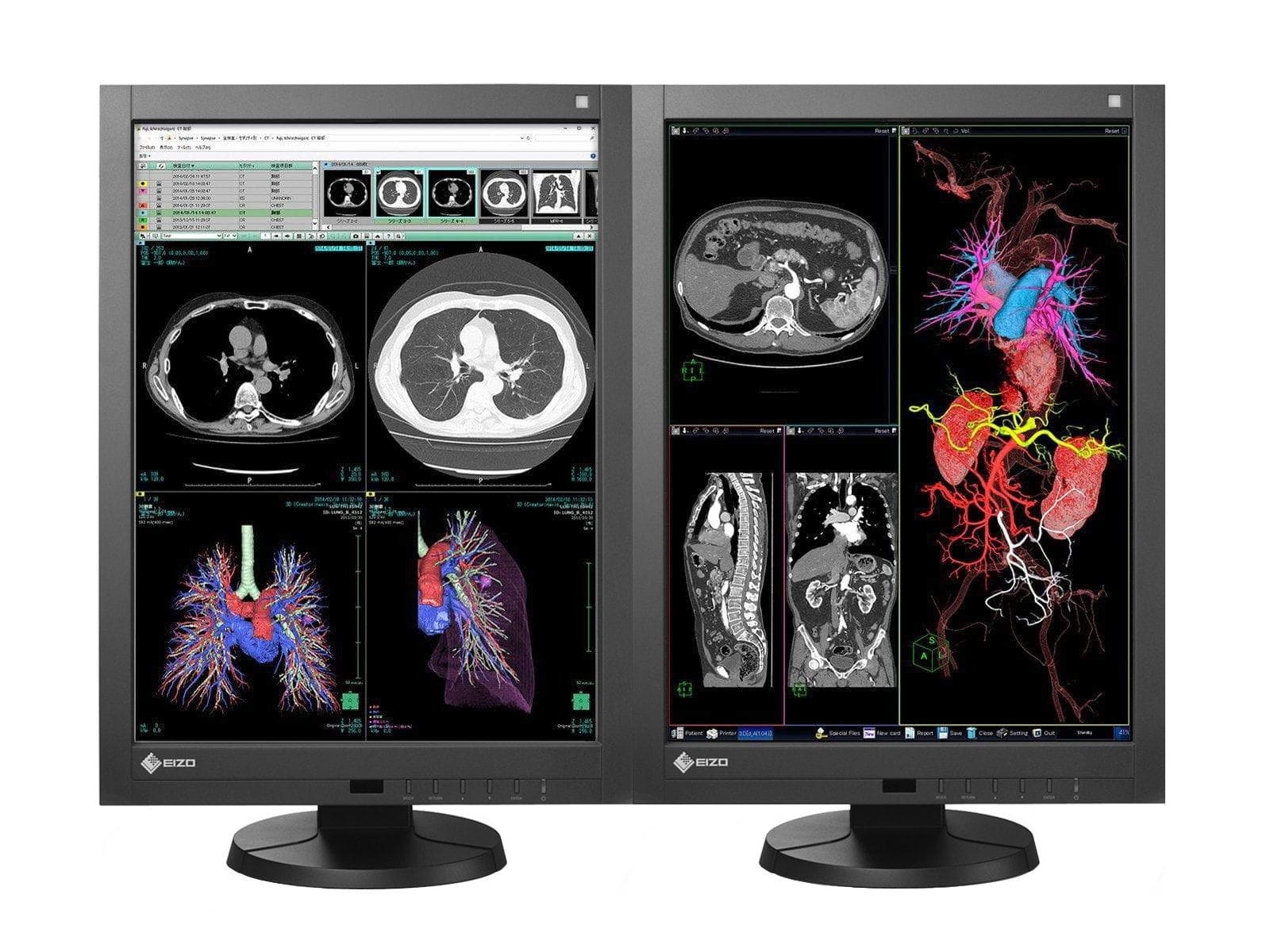 Complete PACS General Radiology Station | Eizo 3MP Color LED Displays | HP Workstation | Dictation Mic | Worklist Monitor (RX340Z2R) Monitors.com 