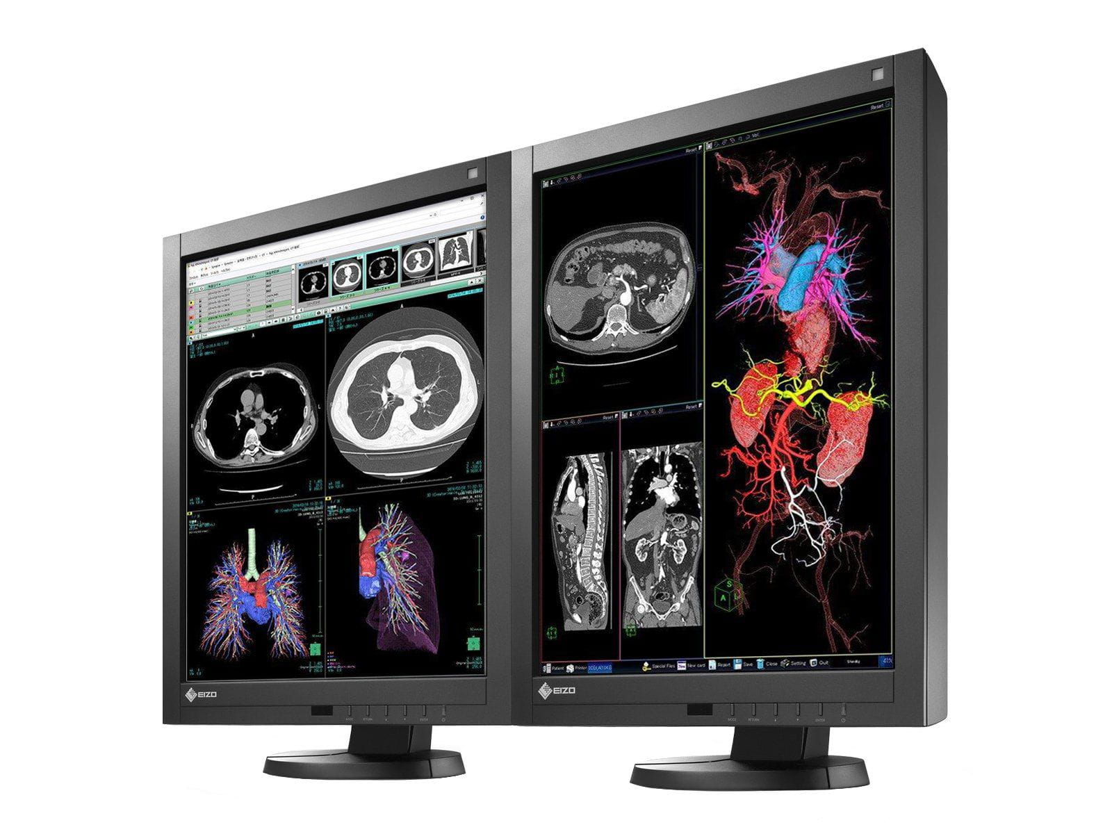 Complete PACS General Radiology Station | Eizo 3MP Color LED Displays | HP Workstation | Dictation Mic | Worklist Monitor (RX340Z2R) Monitors.com 