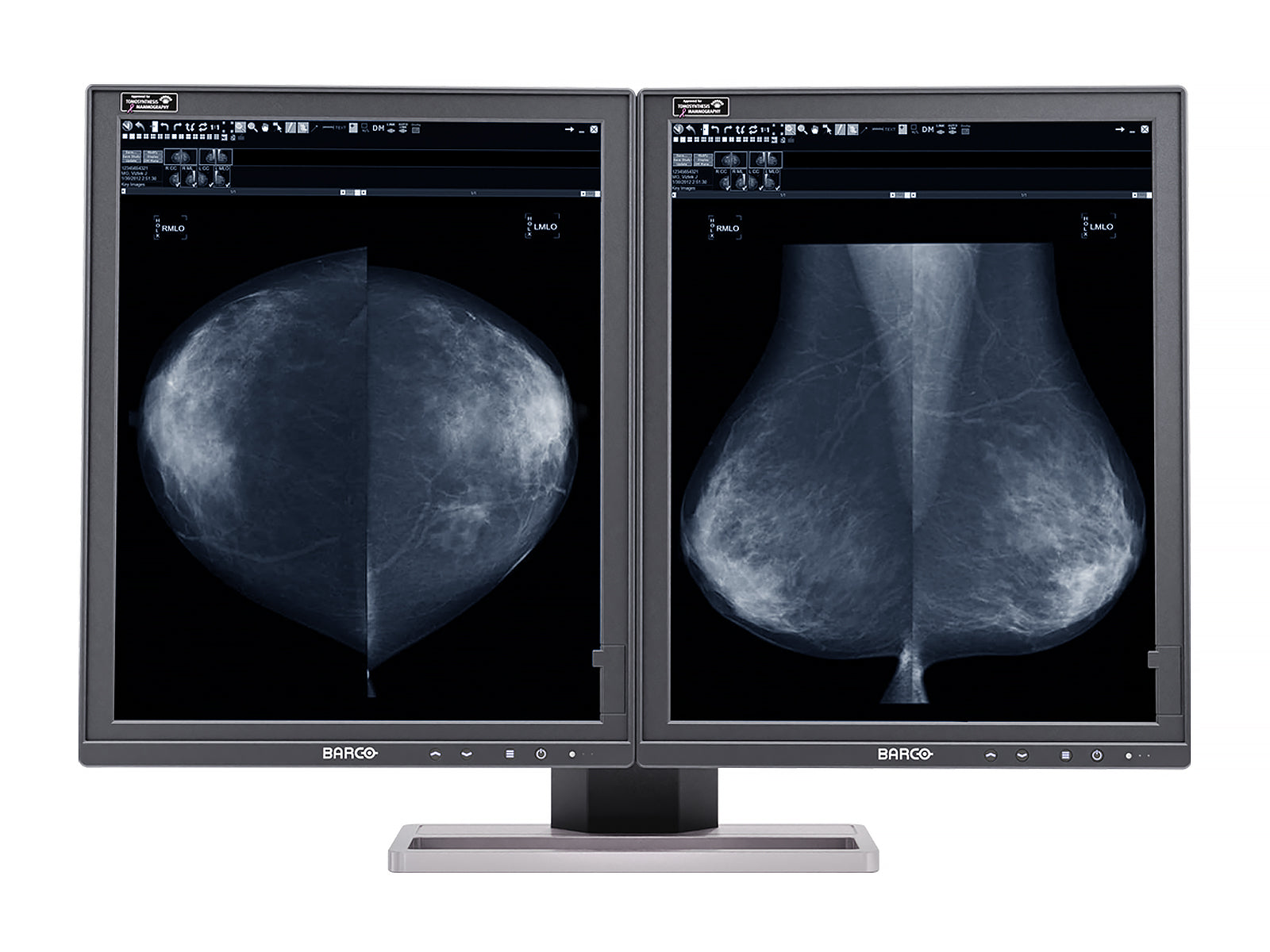 Complete Mammography Reading Station | Barco MDMG-5221 5MP Grayscale LED Monitors | HP Workstation | Dictation Mic | Worklist Monitors (5221Z42221)