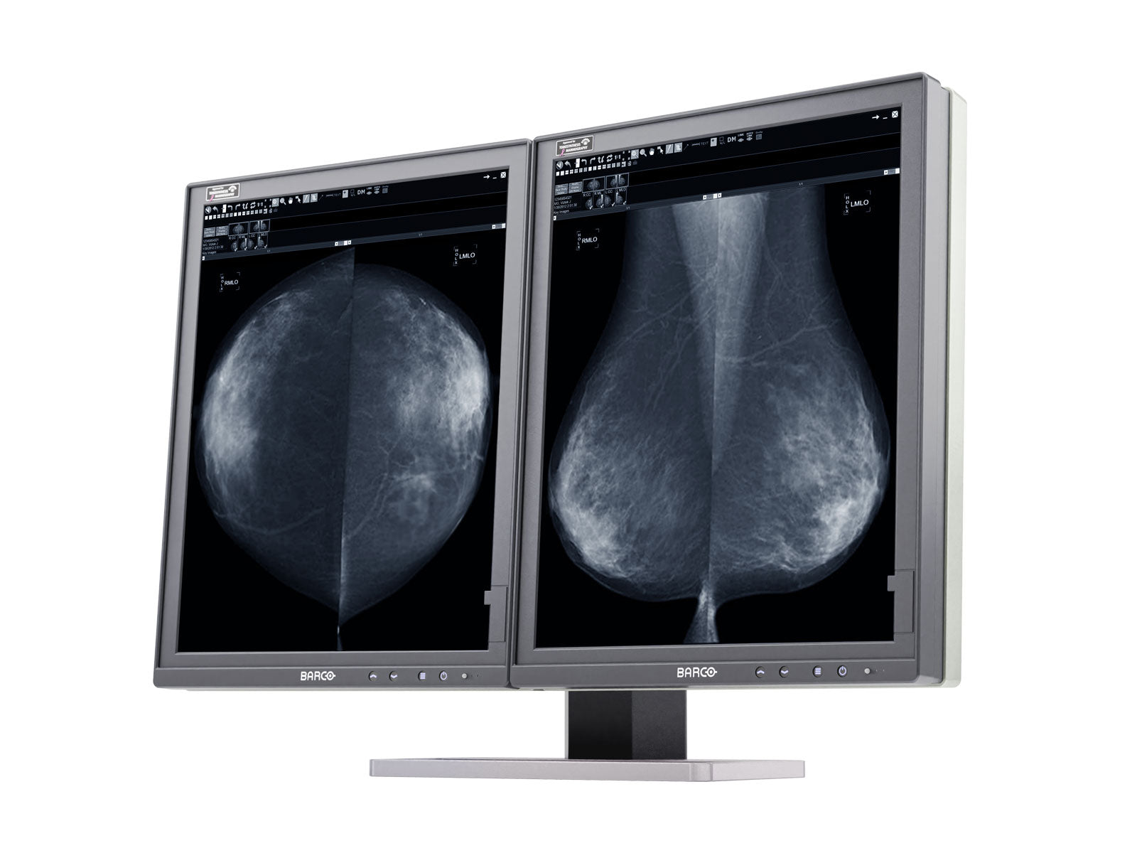 Barco Coronis MDMG-5221 5MP 21" Graustufen-Tomosynthese-LED-3D-DBT-Mammographie-Display