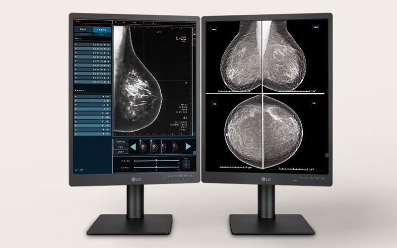 LG 5MP Color Breast Imaging Displays  (21HQ613D)