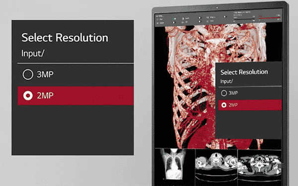 Multi-resolution Mode